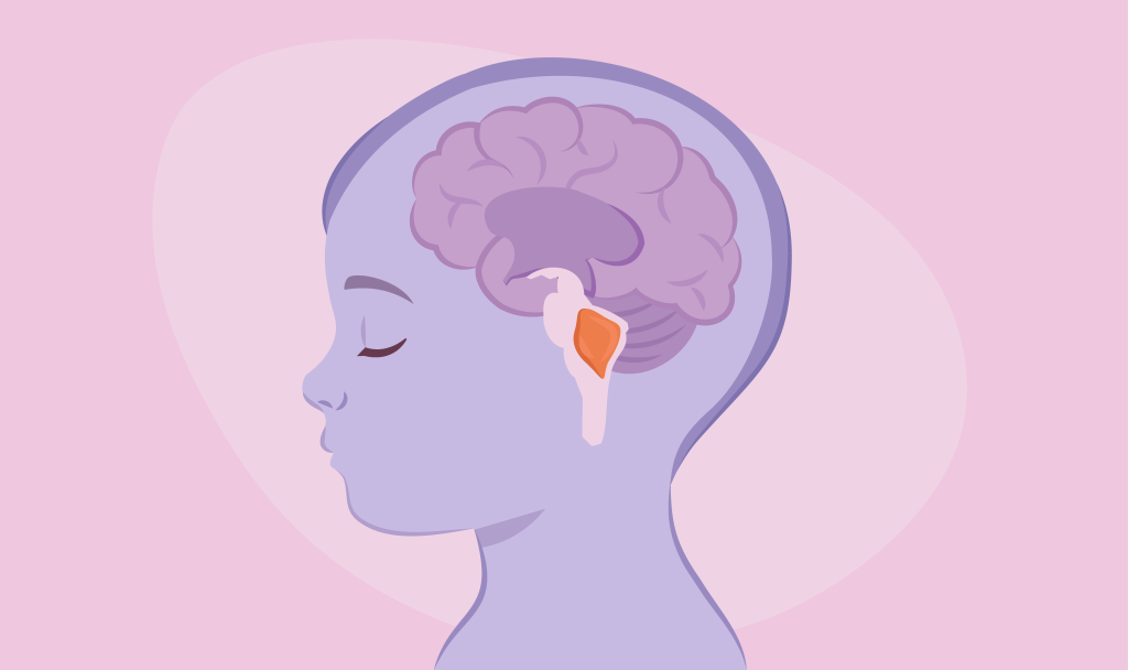 схема с расположением опухоли головного мозга у ребенка